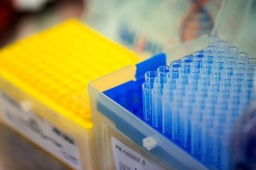Test tubes in lab setting
