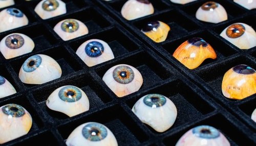 Ocular Prosthetics